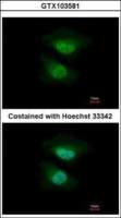 NAB2 antibody