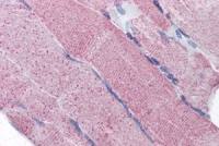 PACE4 antibody, Internal