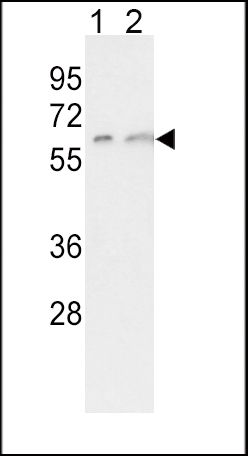 CYP7A1 antibody, C-term