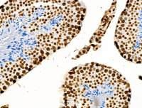 Histone H3K9K14K23K27ac (Acetyl Lys9/Lys14/Lys23/Lys27) antibody