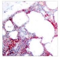 ATF2 (phospho Ser62) antibody