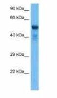 UGT2B17 antibody