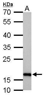 Stathmin 1 antibody