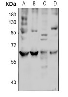 SLC7A8 antibody