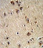 ALAD antibody, C-term