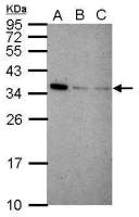 IFI35 antibody