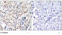 Chk1 (phospho Ser345) antibody