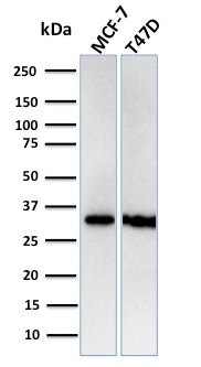 RPA32 antibody [RPA2/3140R]