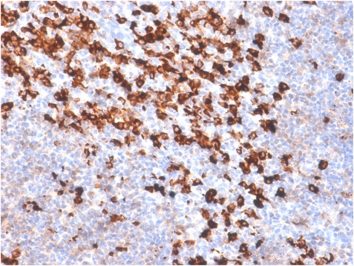 Biotin antibody [BTN/2032R]