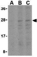 Bid antibody