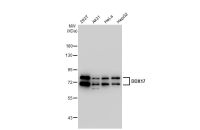 DDX17 antibody [GT1254]