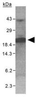 XAGE1 antibody