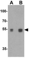 Serine palmitoyltransferase 2 antibody