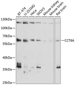 TCP1 zeta antibody