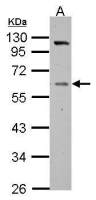Vitamin D Binding Protein antibody