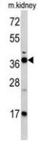 FBP1 antibody, Internal