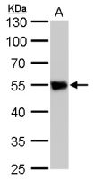 beta Tubulin 2 antibody