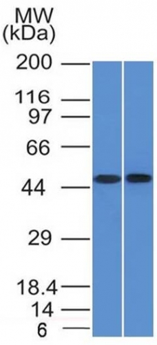 FLI1 antibody [FLI1/1312]