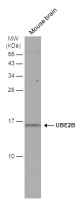 UBE2B antibody