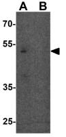 SLC1A7 antibody