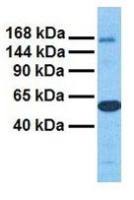 MTUS1 antibody, Internal