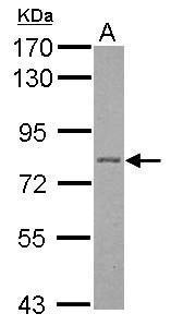 Plakophilin 1 antibody [N2C1], Internal