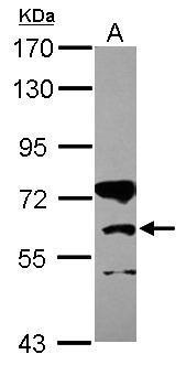 CPT1B antibody [C1C2], Internal