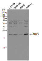 RBBP9 antibody