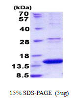 Human LAMTOR2 protein, His tag