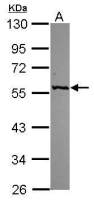 GPT antibody [N2C2], Internal