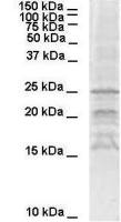 SNAP25 antibody, C-term