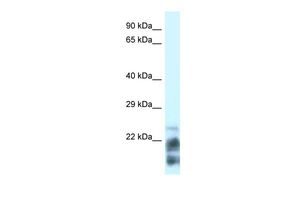 MDP1 antibody, N-term