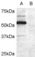 DCDC2 antibody, Internal