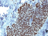 FOXA1 antibody [FOXA1/1514]