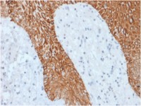 pan Cytokeratin antibody [KRT/1877R]