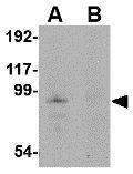 JPH4 antibody