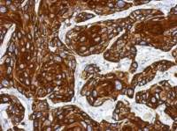 Cytokeratin 17 antibody