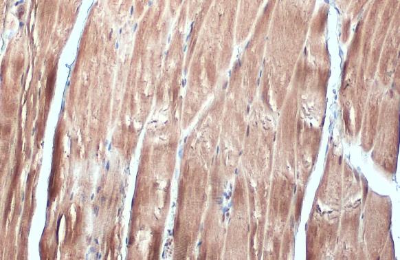 FBXL17 antibody [C1C3]