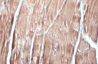 FBXL17 antibody [C1C3]