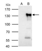 NFAT1 antibody