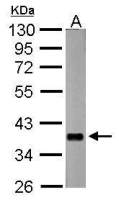 nrv2.1 antibody