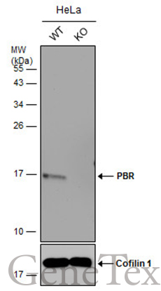 PBR antibody