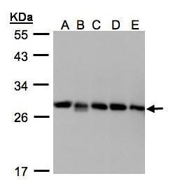 Rho GDI2 antibody [N1C3]