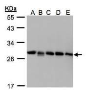 Rho GDI2 antibody [N1C3]