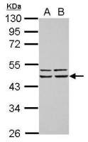 FBXO4 antibody