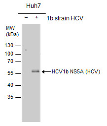 Hepatitis C virus NS5A protein antibody