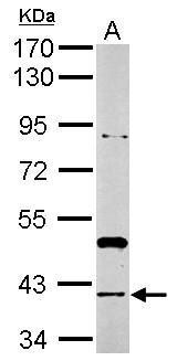 Rad51 antibody