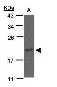 nm23-H3 antibody [C1C3]