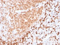 Mesothelin antibody [TCL1/2747R]