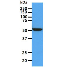 ALDH5A1 antibody [AT17F5]